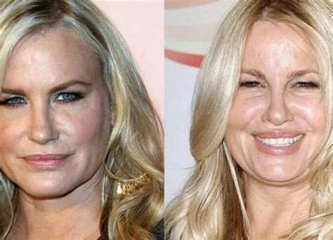 jennifer coolidge before surgery|Jennifer Coolidge Plastic Surgery: Shocking Before and After Look!